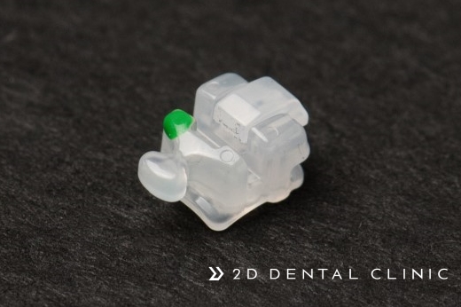 2D교정? 클리피씨? 자가결찰 브라켓! 강남 투디치과 관련 이미지 6