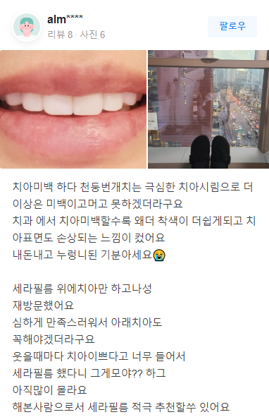 무삭제라미네이트 후기 모음 관련 이미지 6