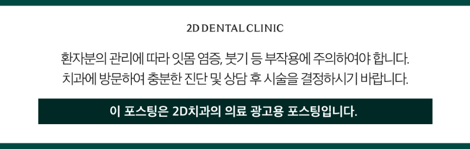 대구무삭제라미네이트 심미치료 숨기지 말고 당당하게 미소 짓기 관련 이미지 12