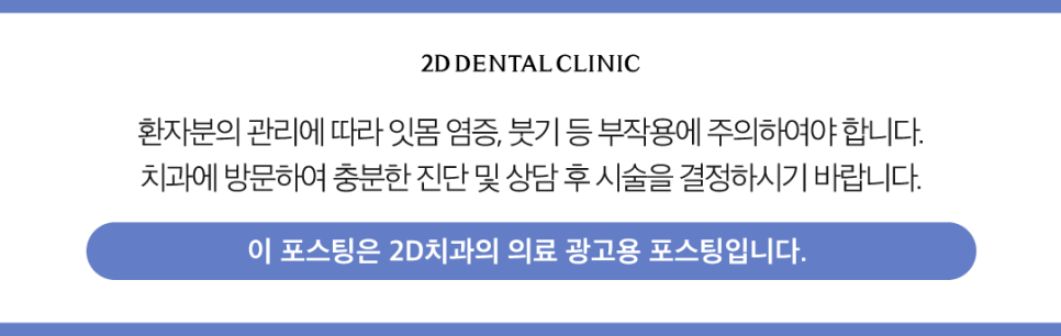 무삭제라미네이트후기 심미보철 나에게 적합한 방식을 찾아보세요 관련 이미지 12