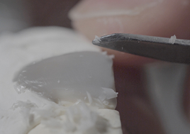 라미네이트 치료 전 체크해야할 부분은? 관련 이미지 6