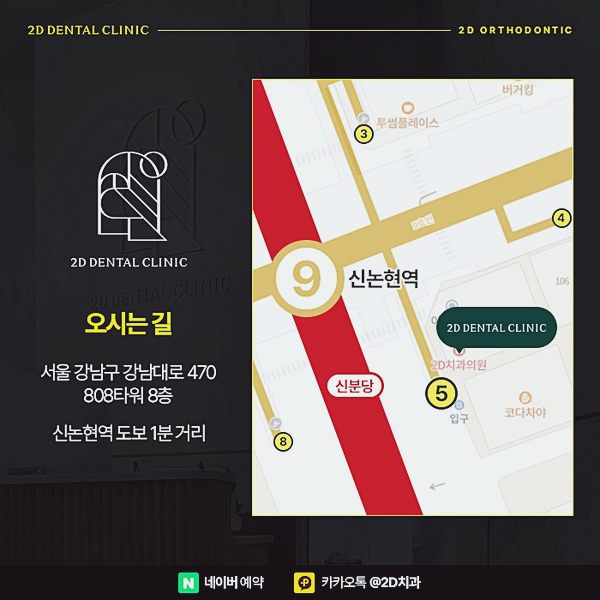 이빨 벌어짐 개선 앞니부분교정가격 비교하고 강남역 부분교정 관련 이미지 8
