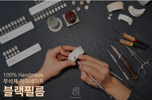 무삭제라미네이트후기 치아삭제없는 블랙필름 관련 이미지 10