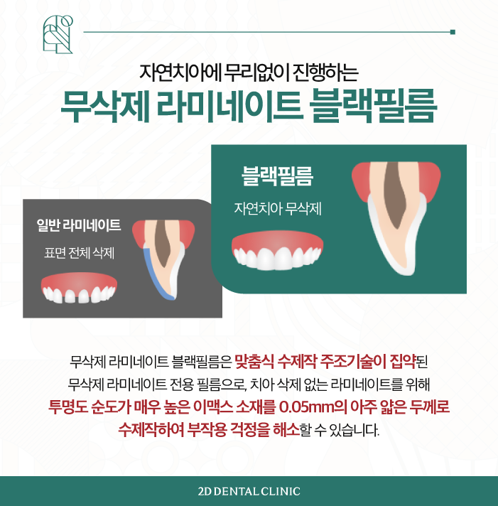 강남역라미네이트 잘하는곳 자연치 그대로 블랙필름 관련 이미지 4