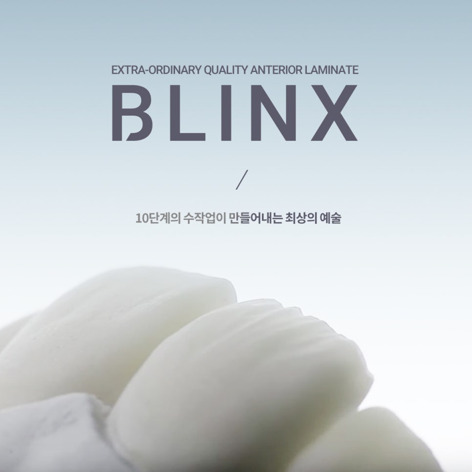 라미네이트에서 중요한 것은..심미적 요소, 블링스 관련 이미지 3