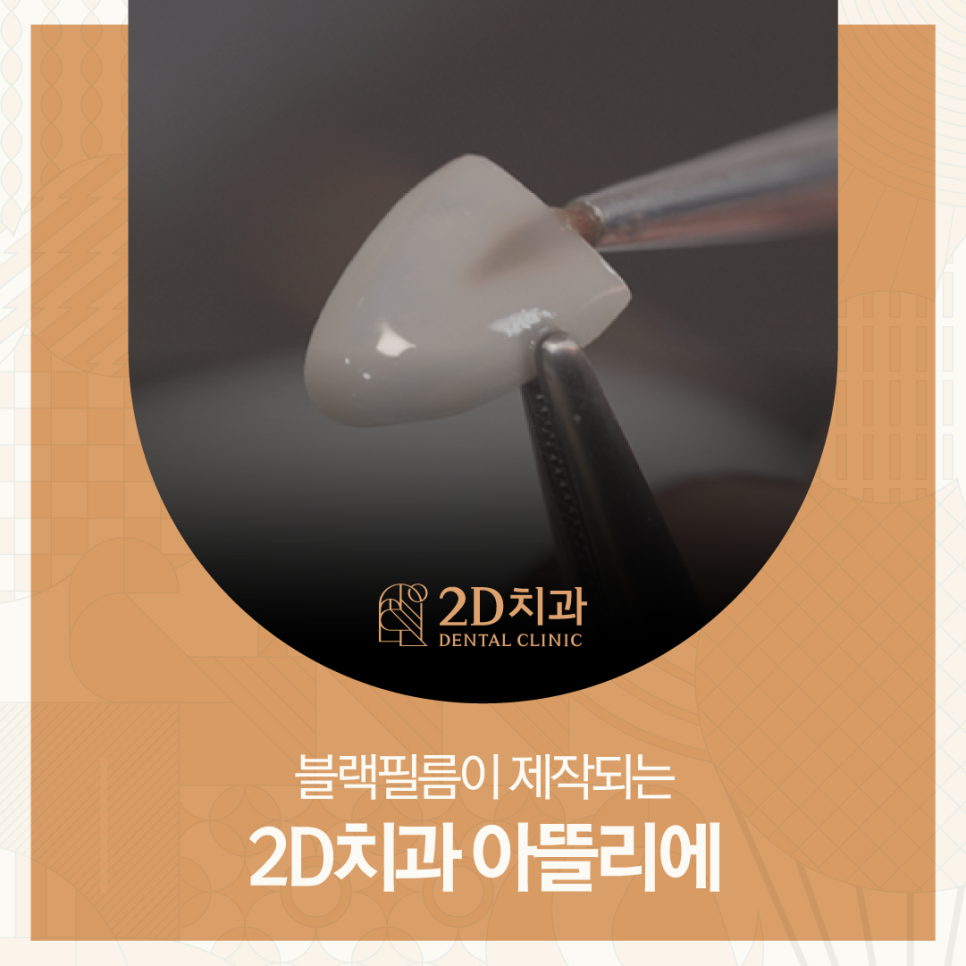 대치동치과 앞니치아변색 개선하는 무삭제 블랙필름 제작은? 관련 이미지 1