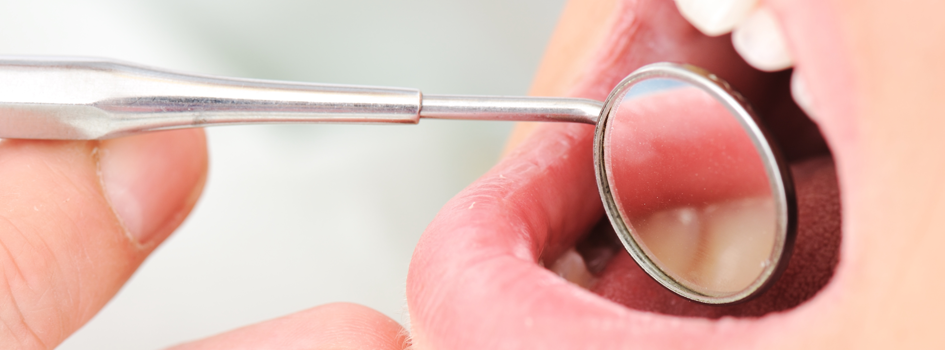 비발치교정, 발치 없이 교정하기! 강남 2D치과 관련 이미지 1