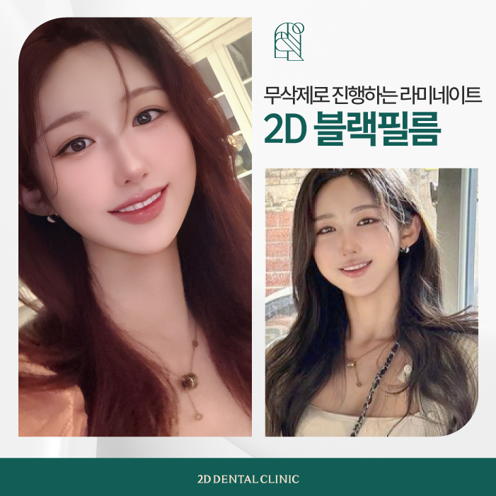 투디치과 무삭제블랙필름 아름다운 앞니 자신감 관련 이미지 6