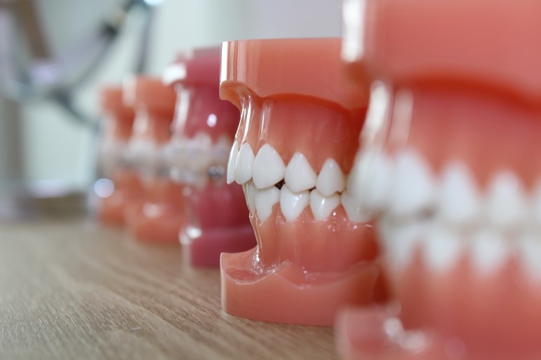 [교정상식] 믿을 수 있는 교정치과 찾기 관련 이미지 6