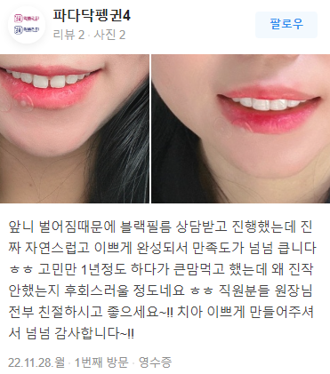 무삭제라미네이트 후기 모음 관련 이미지 9