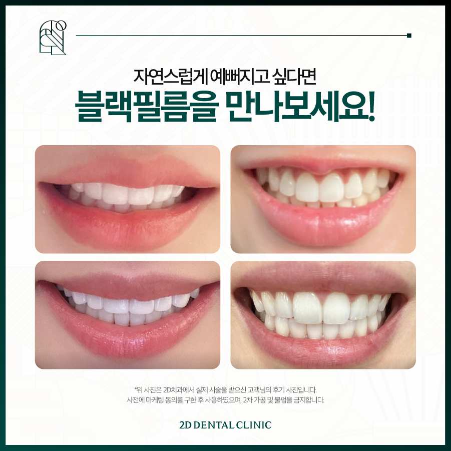 무삭제라미네이트비용 돈 아깝지 않은 블랙필름 관련 이미지 6