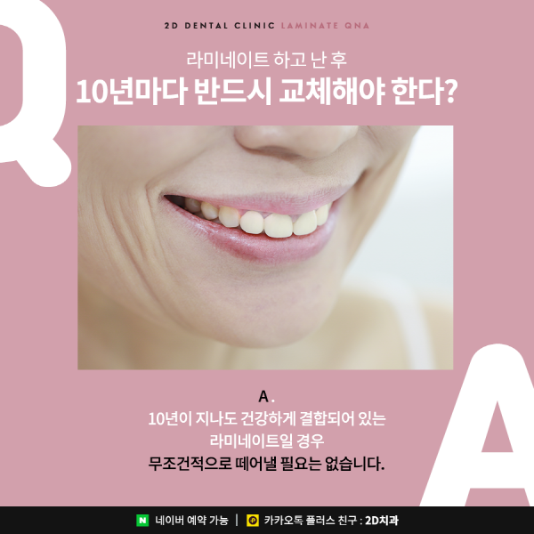 라미네이트 시술 전이라면? 이건 관련 이미지 4