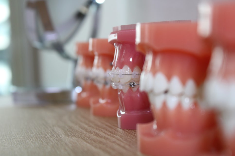 [교정상식] 나에게 딱 맞는, 치아교정? 관련 이미지 3