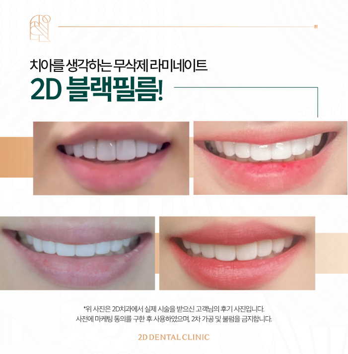 무삭제라미네이트가격 블랙필름 하기 전 체크하기! 관련 이미지 7