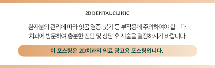 무삭제라미네이트가격 블랙필름 하기 전 체크하기! 관련 이미지 13