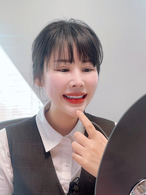 현직 2D 치과위생사가 시술한 무삭제 라미네이트 블랙필름 옥니개선 후기 관련 이미지 4