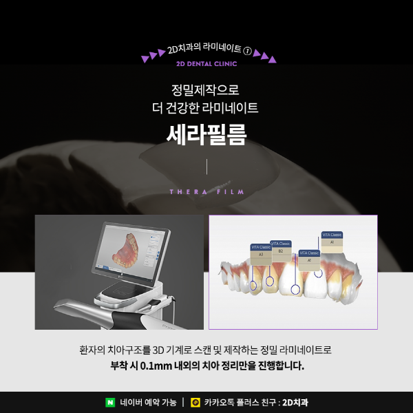 "다시 복구 못해요" 앞니라미네이트 치아 삭제량이 중요한 이유 관련 이미지 5