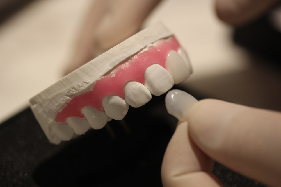 무삭제 라미네이트잘하는곳 잘 찾는 법! 관련 이미지 10