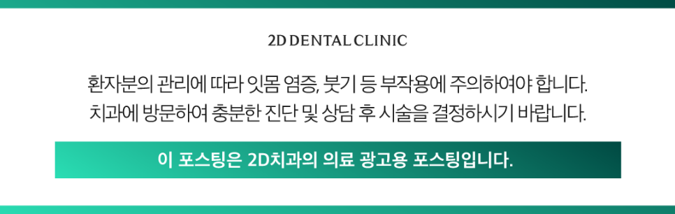 무삭제라미네이트부작용 치아부분변색 얼룩진 앞니 개선 관련 이미지 13