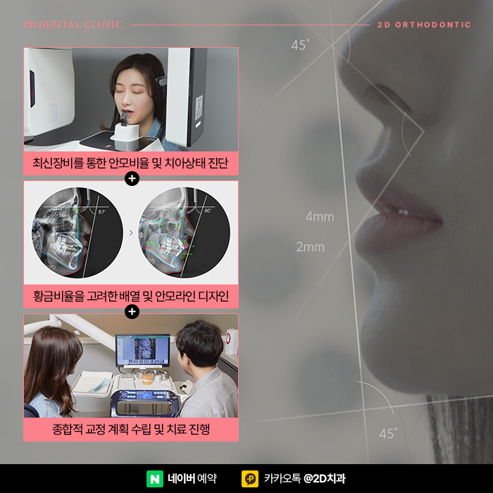부정교합, 황금비율 안모 라인을 위한 신논현역 2D치과의 치아교정 관련 이미지 4