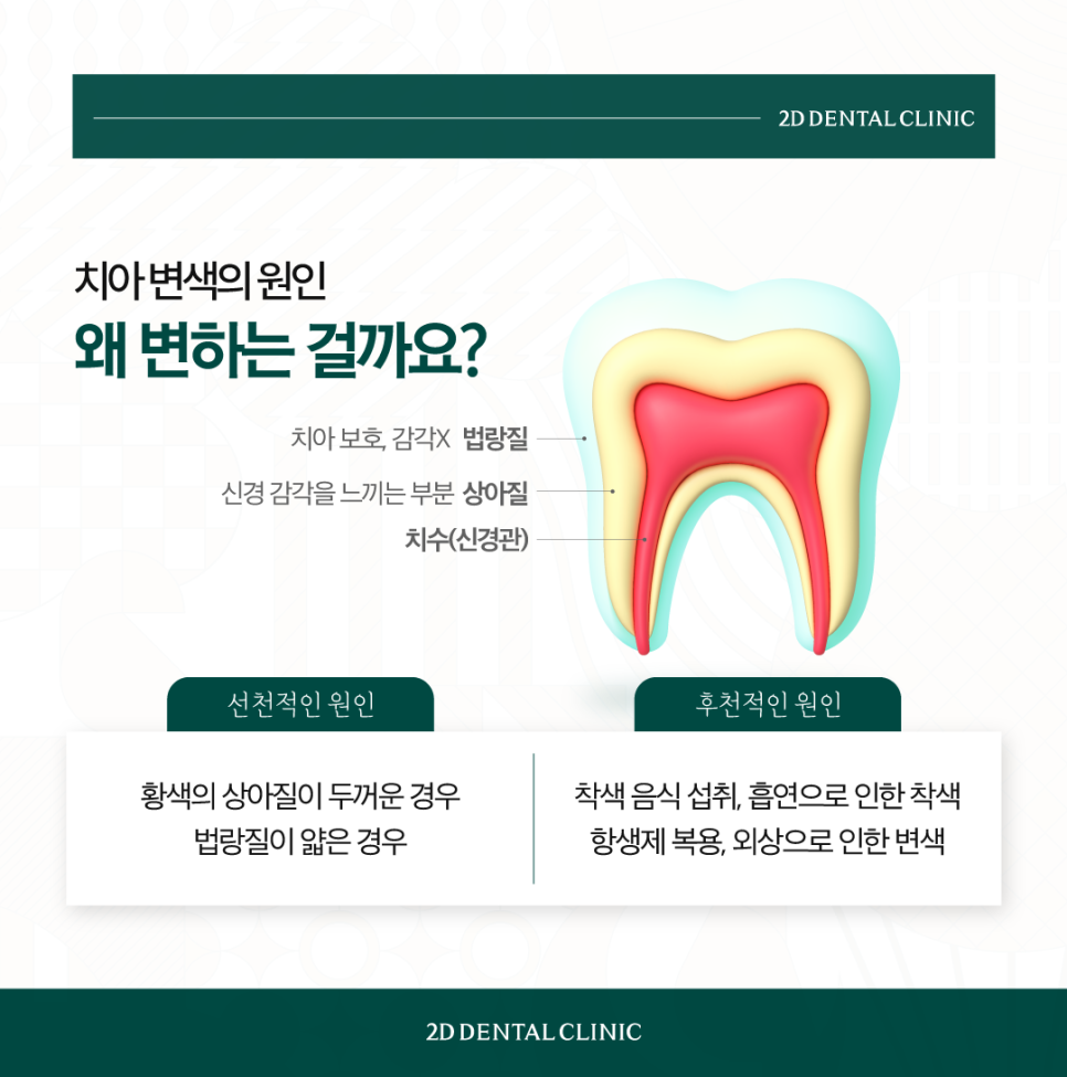 인천무삭제라미네이트 앞니치아변색 커피 먹고 누런 이 다시 하얗게 관련 이미지 3