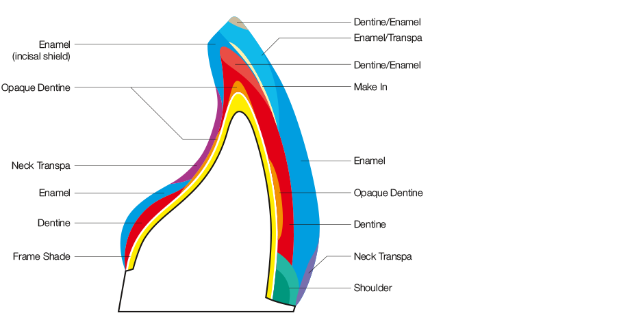 라미네이트에서 중요한 것은..심미적 요소, 블링스 관련 이미지 8