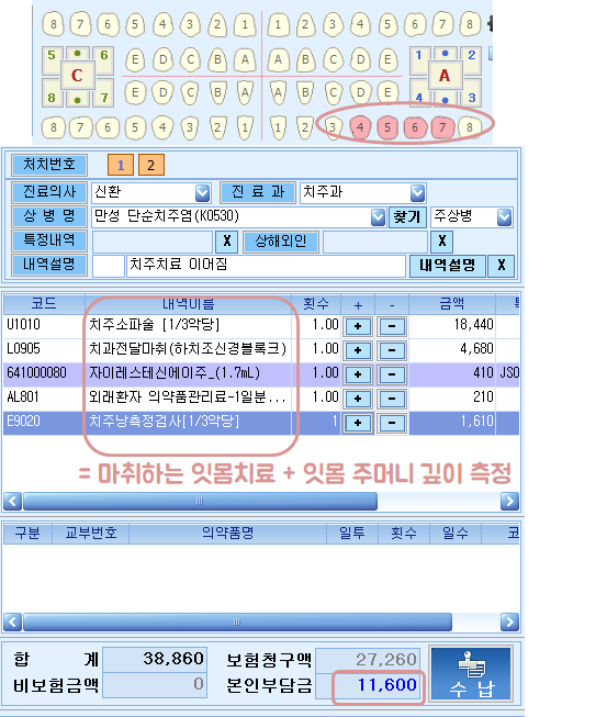 2021 스켈링 비용, 치석제거 스케일링 잇몸치료 가격 총정리 관련 이미지 17