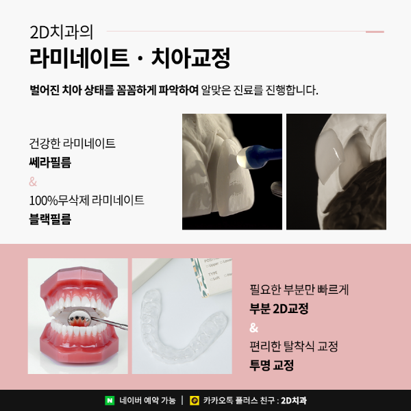 벌어진앞니는 라미네이트? 치아교정? 이렇게 선택하세요 관련 이미지 6