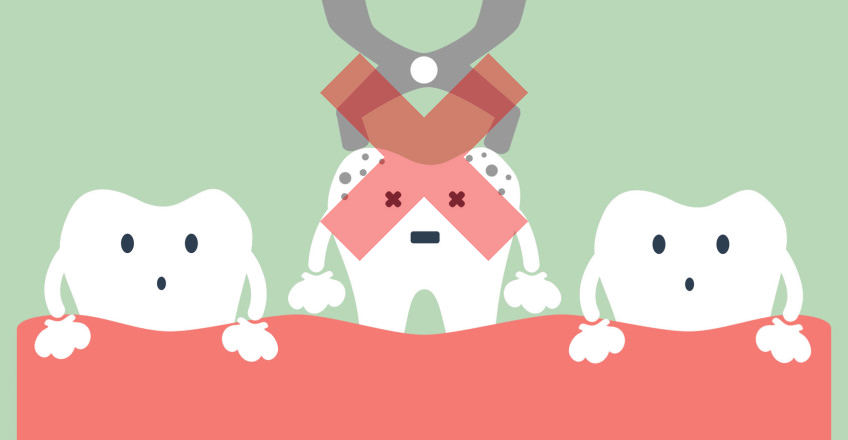 비발치교정, 발치 없이 교정하기! 강남 2D치과 관련 이미지 3