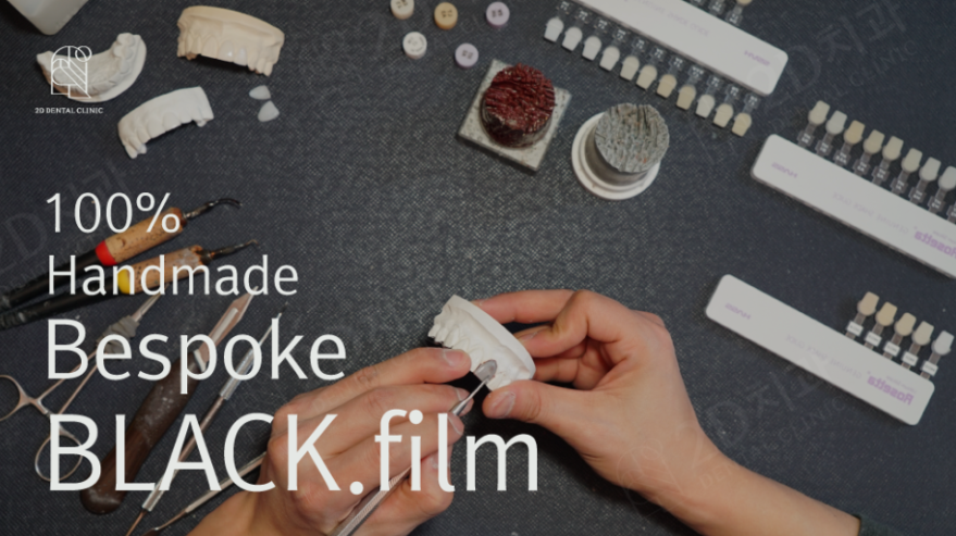 앞니깨짐 앞치아치료는 무삭제라미네이트 블랙필름 관련 이미지 6