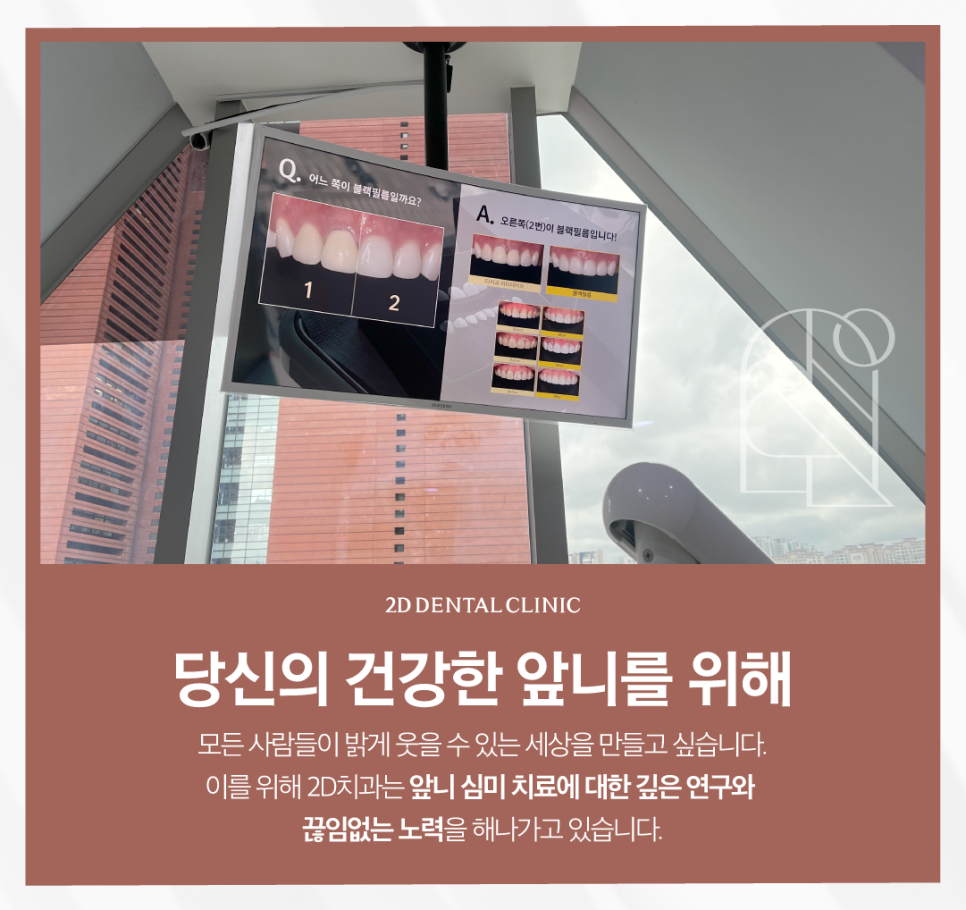 광주무삭제라미네이트 심미보철 치아 지키면서 예쁜 모양이 되려면 관련 이미지 9