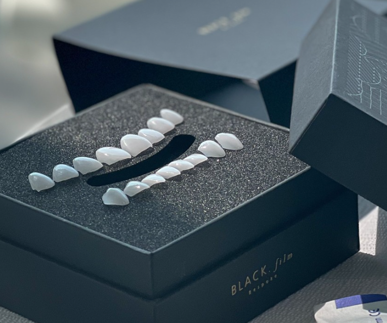 블랙트라이앵글 치아사이틈 개선은 무삭제라미네이트 블랙필름 관련 이미지 6