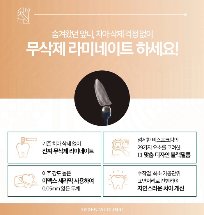 무삭제라미네이트 앞니성형 꼼꼼하게 진행하려면 관련 이미지 4
