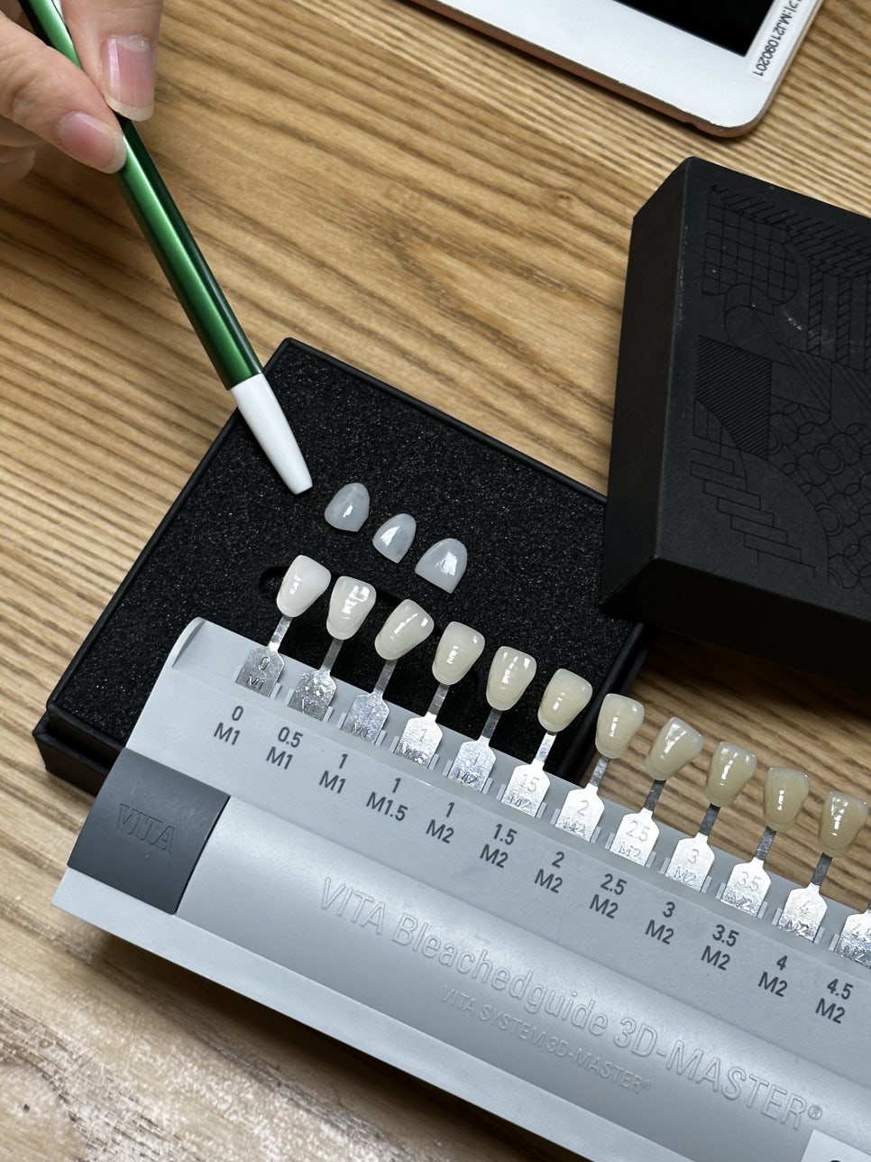 옥니 라미네이트 치아고민은 그만 치아삭제 없는 블랙필름으로 해결 관련 이미지 7