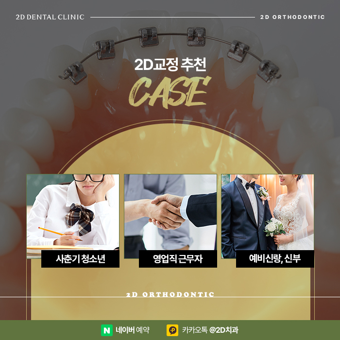 아무도 모르게 티 안나는 연예인교정으로 강남역 교정치과 관련 이미지 4