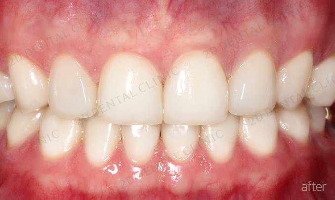 김현진 연애의맛? 또 어디서 봤더라? 관련 이미지 10