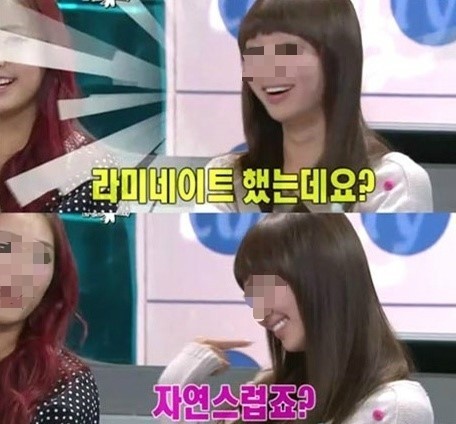 라미네이트 통증없는 2회 방문으로 시술 가능한 블랙필름 관련 이미지 2