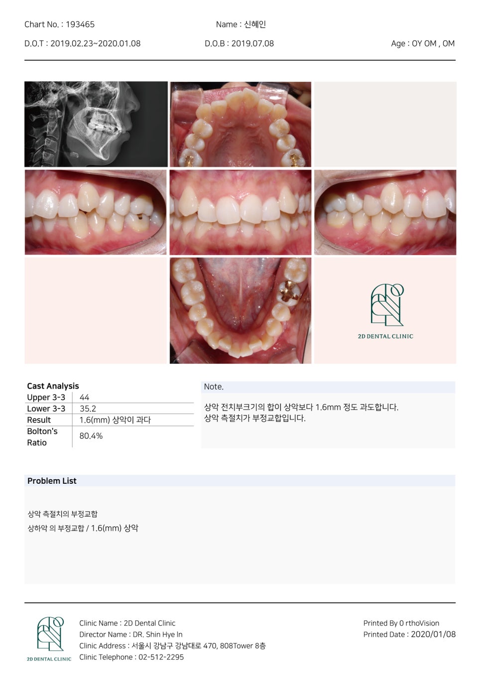 돌출입 탈출기! 덧니 교정도 문제없어! by.투디치과(2D치과) 관련 이미지 4