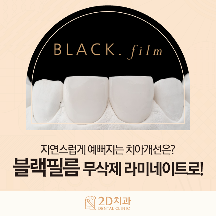 무삭제라미네이트비용 앞니 콤플렉스 극복은 블랙필름으로 관련 이미지 1