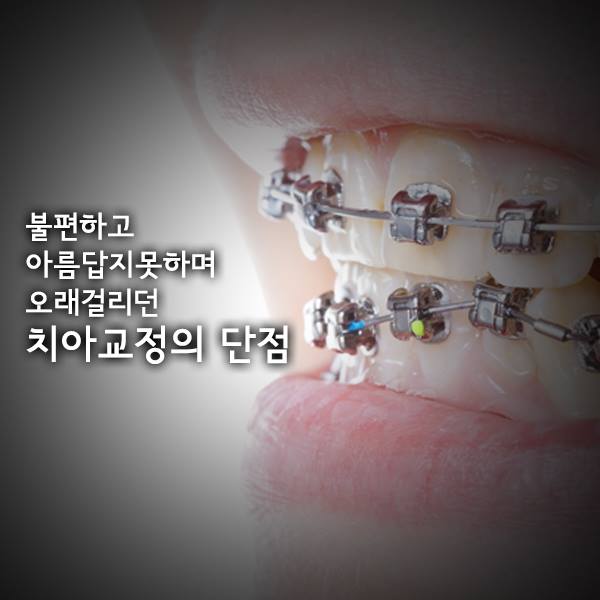 [투디(2D)치과] 2D교정에 대해 아시나요? 관련 이미지 2