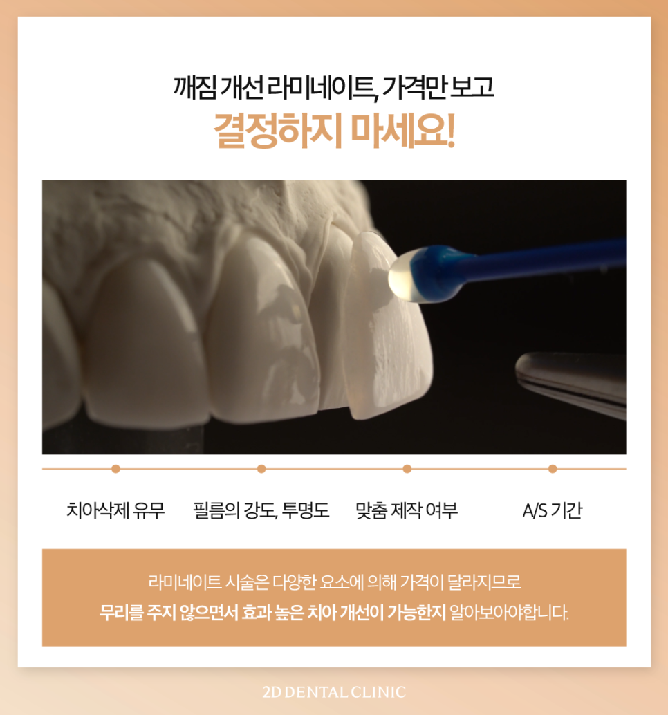 대구무삭제라미네이트 앞니깨짐비용보다 이것에 집중해 주세요! 관련 이미지 4