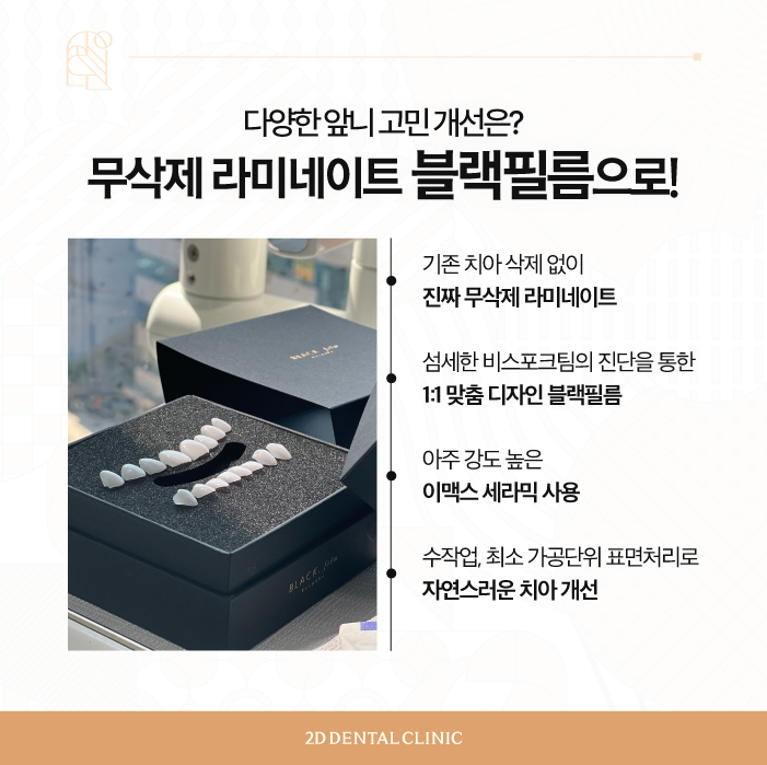 무삭제라미네이트비용 앞니 콤플렉스 극복은 블랙필름으로 관련 이미지 4