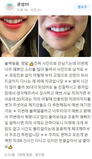 블랙필름 치아 가격 정확히 알고싶다면? 관련 이미지 12