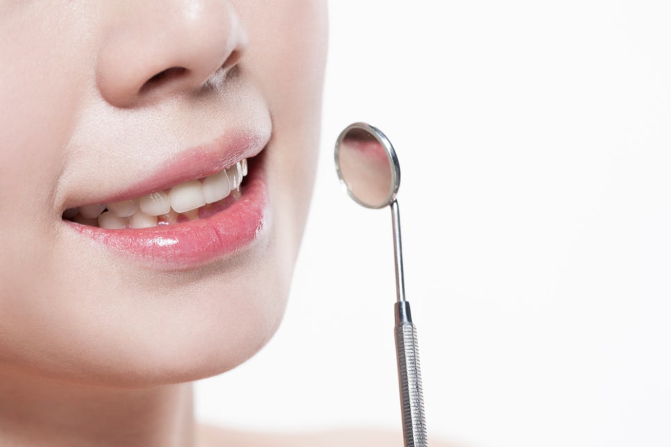 치아착색 없애기 위해서는 관련 이미지 3