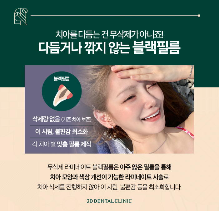 대구무삭제라미네이트 시술 후에도 철저한 사후관리 관련 이미지 3