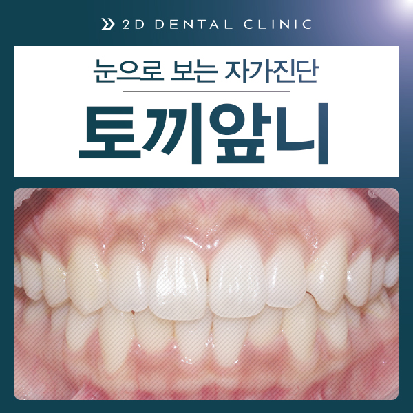케이스로 확인하는 토끼이빨, 교정전문 2D치과 관련 이미지 2