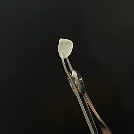 치아블랙필름 무삭제 라미네이트 시술시간, 유지기간, 비용 관련 이미지 3