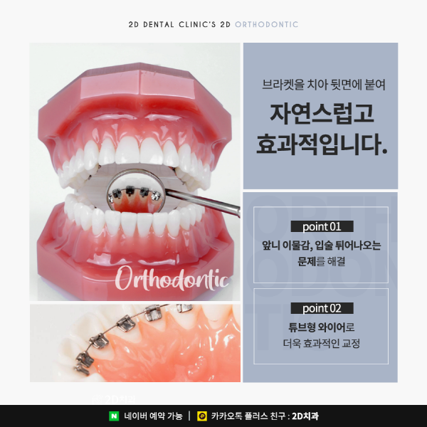 앞니가 고민이라면? 답은 <2D교정> 관련 이미지 4
