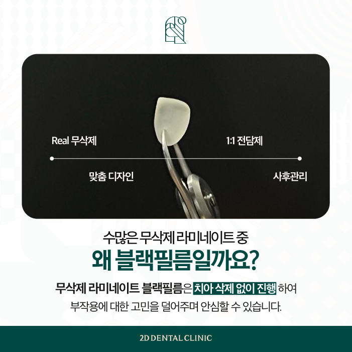 강남라미네이트치과 블랙필름 치아성형 가격과 효과는 어떨까? 관련 이미지 4