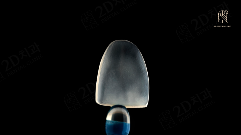 라미네이트잘하는곳 2D치과 김현모대표님 인터뷰 관련 이미지 9